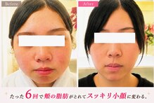 サロンドエステケイワイ(de KY)