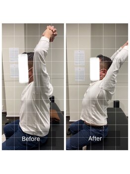 ナオル整体 浅草院(NAORU整体)/50代男性 背中痛・デスクワーク