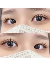 ロゼッタ(Rosetta)/メーテルロッド