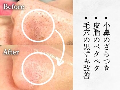 エムエー(MA)の写真