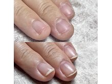 「爪や指先にコンプレックスがある…」そんな方に！