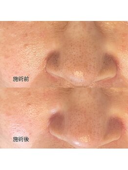 エムアンドユウ(m&u)/もう諦めていました