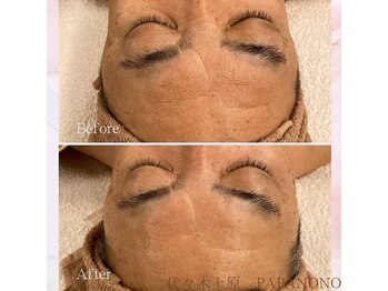 ビューティーラボ パパノノ(BEAUTY LABO PAPA NONO)/メンズフェイシャルも大人気!