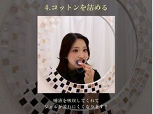 ホワイトニングサロン ホワイト 天童店(WHITE)/4.コットンを詰める