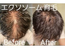 アン 銀座(ann)/エクソソームで分け目フサフサに