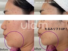 ミラ 中央林間(mira)の雰囲気（<引き上げ>[小顔/小顔リフト/たるみリフトアップ］）