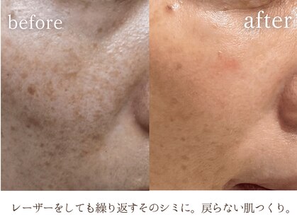 キレイ(KIREI)の写真