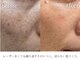 キレイ(KIREI)の写真