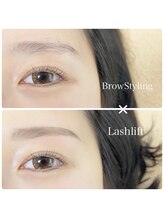 シュシュ(chou chou)/