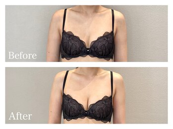 ククナ(KUKUNA)/*バストアップマッサージ*