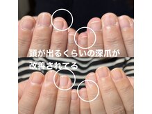 スティラ(Stila)/自爪育成/深爪育成/ジェルネイル
