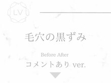 ラヴィオーラ 名駅(LaViora)/ダイヤモンドハーブピーリング