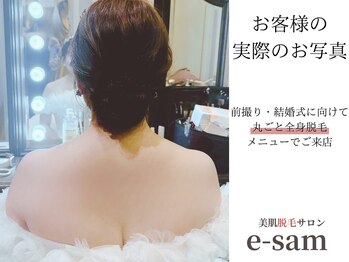 イーサム 高槻摂津富田店(e-sam)/丸ごと全身脱毛