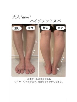【よもぎ蒸し温活痩身×水素吸入】YOSAPARK ALUA FEM/ むくみ改善！-水素フットバス-