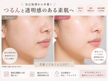 バービーグロウ 恵比寿(Barbie Glow)/夏のメイク崩れ激減/美白肌脱毛