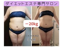 ダイエット サポート(DIET SUPPORT)