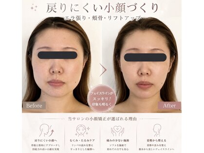 ハイコガオ(HIKOGAO)の写真
