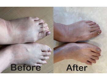 オハナ ハレ ザファームCS60(Ohana Hale The Farm CS60)/酷かった足のむくみ