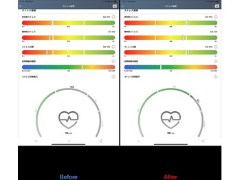 かげやま鍼灸接骨院/数値の変化が！