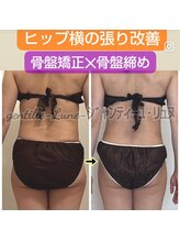 ルンソルテ(lunsoleto)/太もも横張り、ヒップアップ