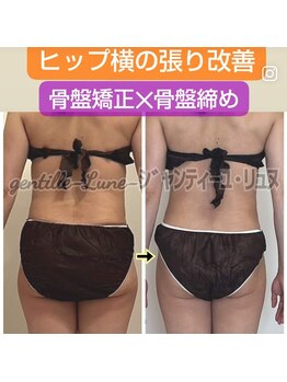 ルンソルテ(lunsoleto)/太もも横張り、ヒップアップ