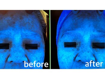 ファイブエレガンテ(5Elegante)/