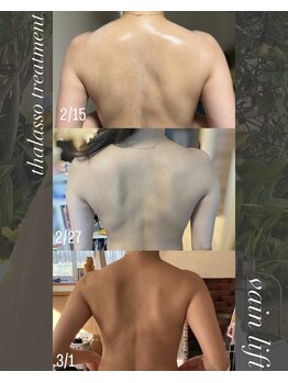 レイドボーテ(Ray de beaute)/ブライダル◎肩甲骨スッキリ！