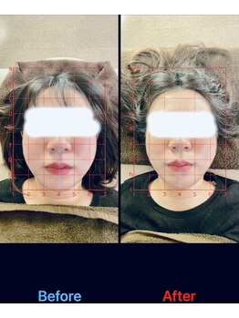 トーラス 整体(TORUS)/輪郭・エラ矯正