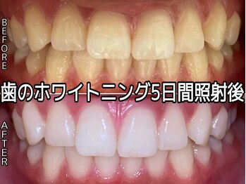 ヴィオール 名古屋栄店(VIOR)/染みない　ホワイトニング