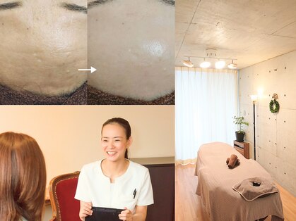 エメ(Eme)の写真