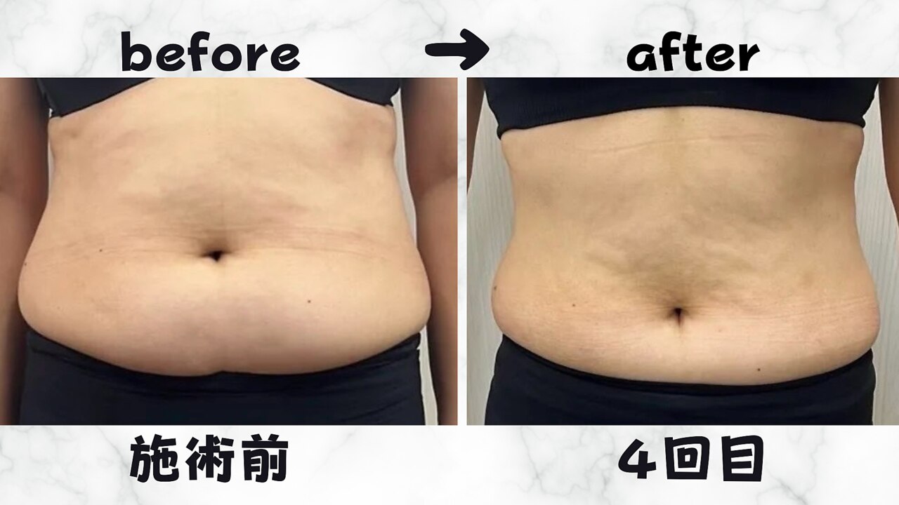 ネオン(Neon)｜ホットペッパービューティー