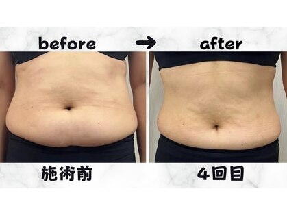 ネオン(Neon)の写真