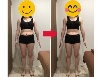 美容整体院元 光の森店/40代S.K様のビフォーアフター