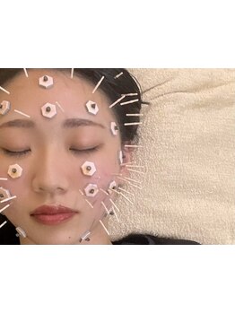 小顔になりたい