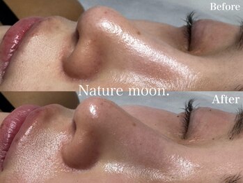 ナチュールムーン(Nature moon.)/毛穴洗浄