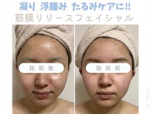 ルポ(repos)の雰囲気（1度でも効果を感じられる技術【痛みの少ない筋膜リリース】）