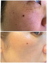 美肌ワークス(美肌works)/見違えるほど美しく