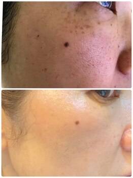 美肌ワークス(美肌works)/見違えるほど美しく