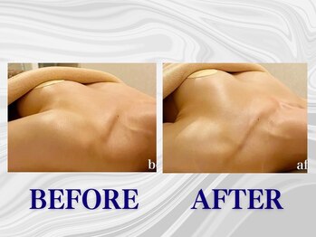 ザモア 福岡天神(THE MORE)/【症例 Before After】