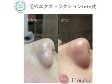 フルリール(Fleurir)/鏡を見て気になっていませんか？