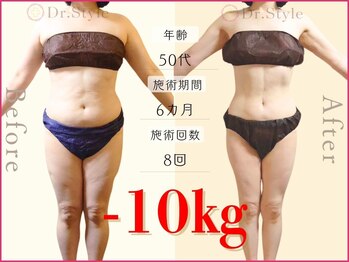 ココア整体 岐阜店(cocoa整体)/最新痩身マシン/脂肪燃焼リンパ