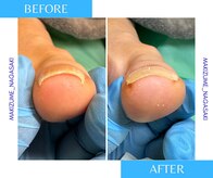 巻き爪補正店 長崎店