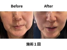 ティアレソワン(tiare soin)の雰囲気（ほうれい線・たるみ・リンパ詰り・毛穴などお悩み方におすすめ。）