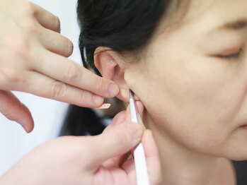 癒やし局の写真/つい食べてしまうのは"弱い意志のせいじゃない?!"耳つぼで食欲調整・体質改善、ガマン知らずの卒業宣言を!