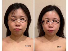 ムーロ(muro.)/コルギ