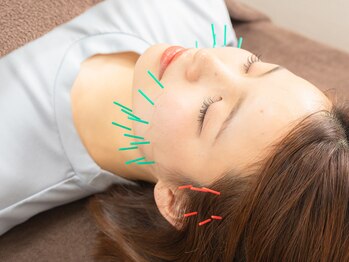 たくみ整骨院 綱島西口院の写真/美容鍼で理想の小顔へ！首肩こりも解消し、肌の悩みまでケア◎至福のひとときを☆