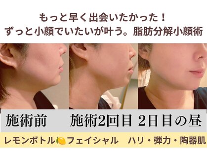 エス シークレット 金町店(S secret)の写真