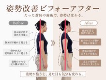 スマイルアップ 梅田院の雰囲気（【整体/鍼灸/腰痛/肩こり/美容鍼/小顔美容鍼/肩こり/美容鍼】）