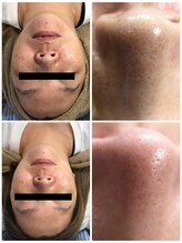 アイマイミー(i my me.)/新メニュー