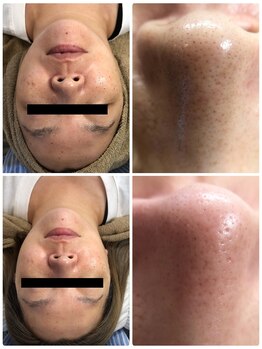 アイマイミー(i my me.)/新メニュー